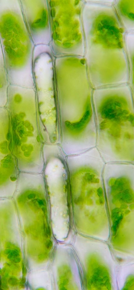 Plant cells under a microscope