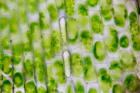 Plant cells under a microscope